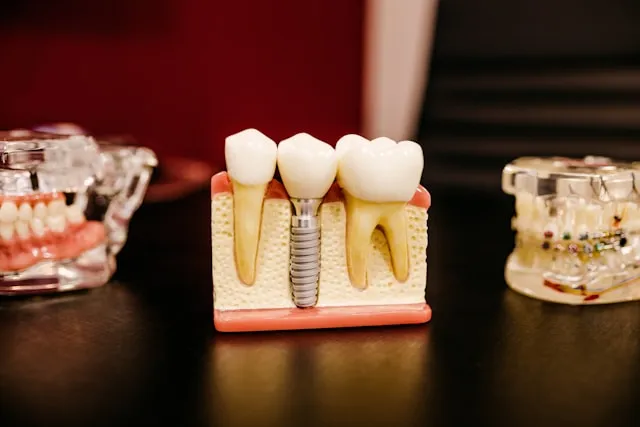 Ortodoncja a chirurgia szczękowa: kiedy jest potrzebna współpraca?